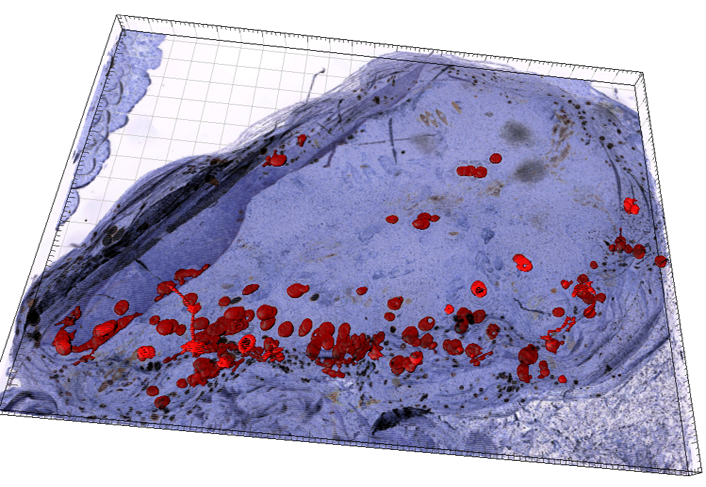Memorial Sloan Kettering Cancer Center Uses Voloom for 3D Reconstruction of Immunofluorescence Serial Sections