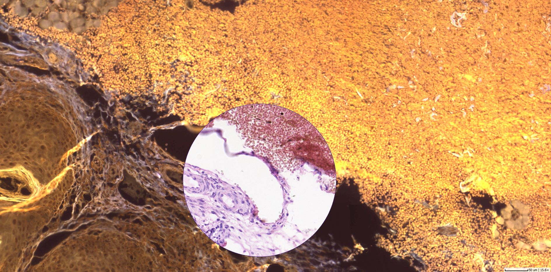 Digital Multiplexing of Brightfield and Fluorescence Whole Slide Images