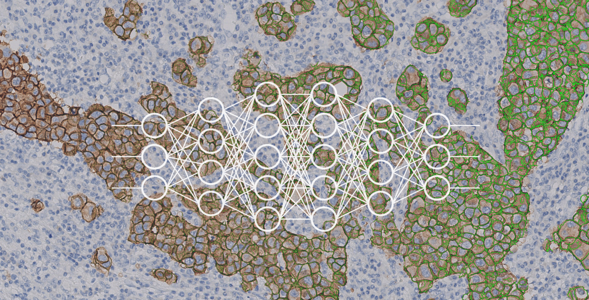 What’s all the fuss about deep learning and how will it impact pathology? (Part 1)