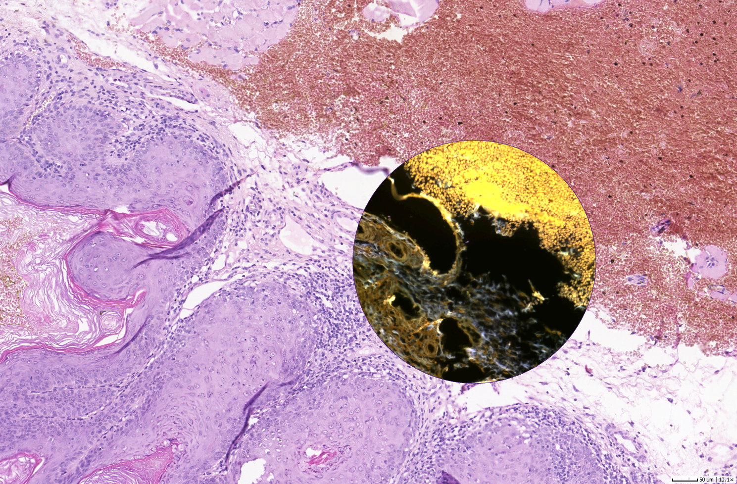 Slidematch™ now features Alignment of Brightfield and Fluorescence Whole Slide Images