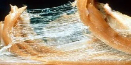 Fascia - health - mindbodyconnection - fascial system.jpg