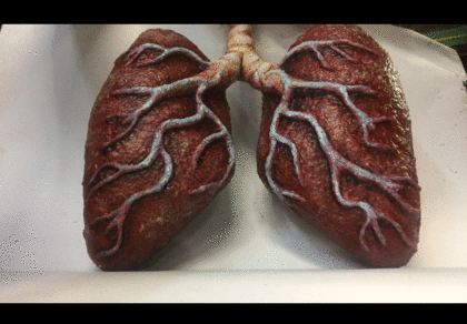 GLOMBOT Lungs