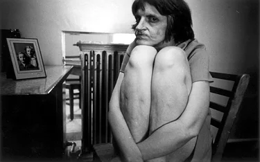 Ward 81, Oregon State Hospital, Salem, Oregon, 1976. Photography by Mary Ellen Mark