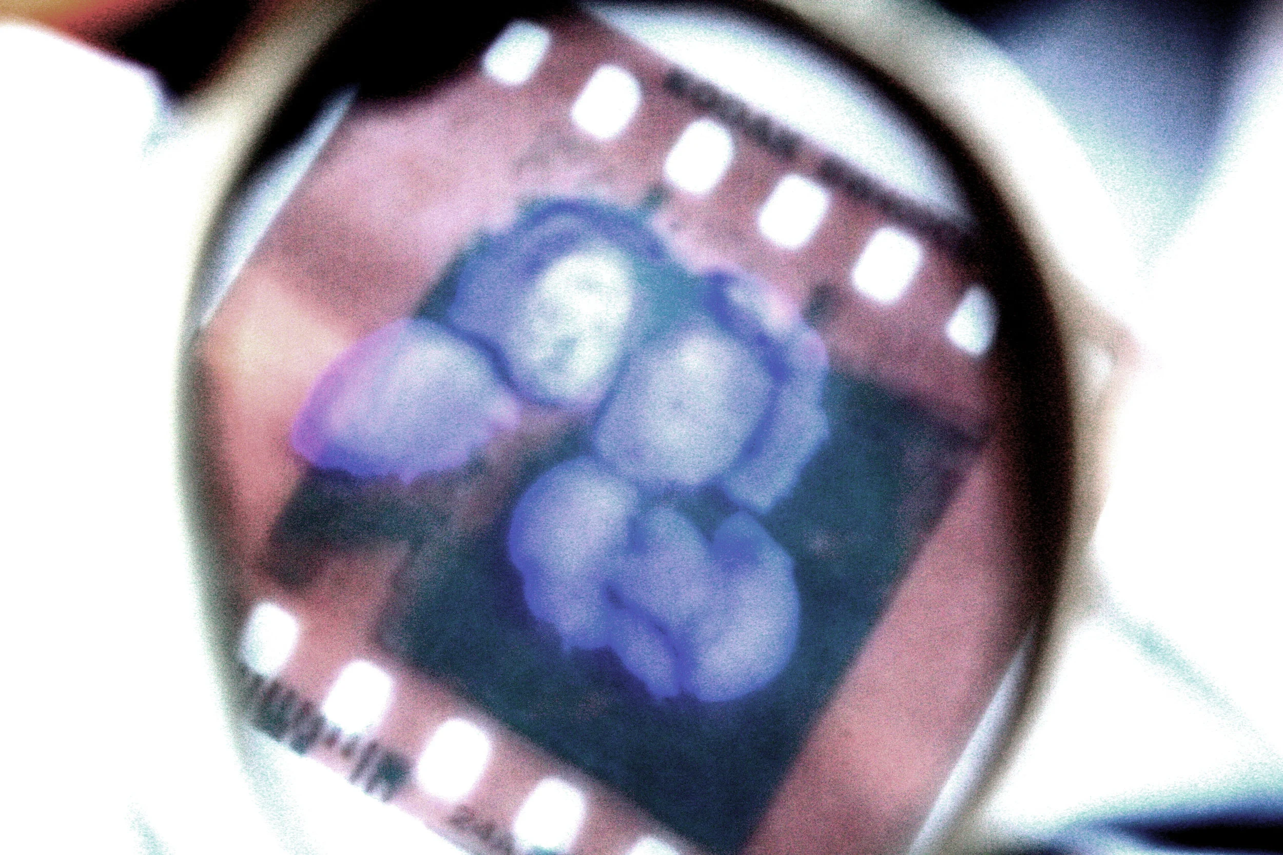 Filter