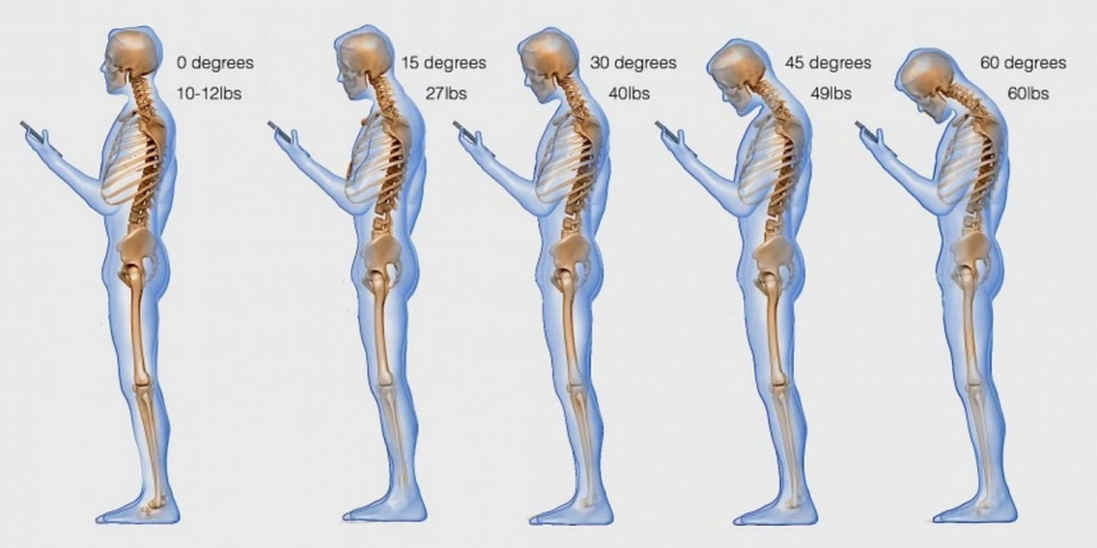 Text+Neck+Syndrome.png