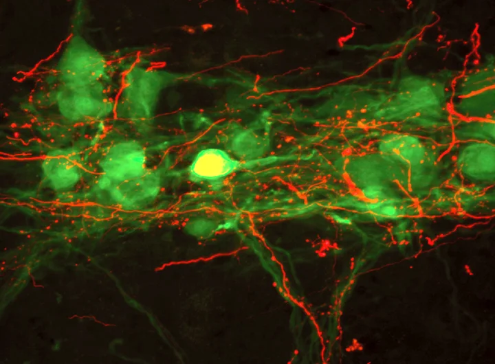 The above photo is taken from a published manuscript ( Lane et al. (2008) Journal of Comparative Neurology ). Our research team uses experimental models of cervical spinal cord injury to assess how breathing is impaired, explore the p