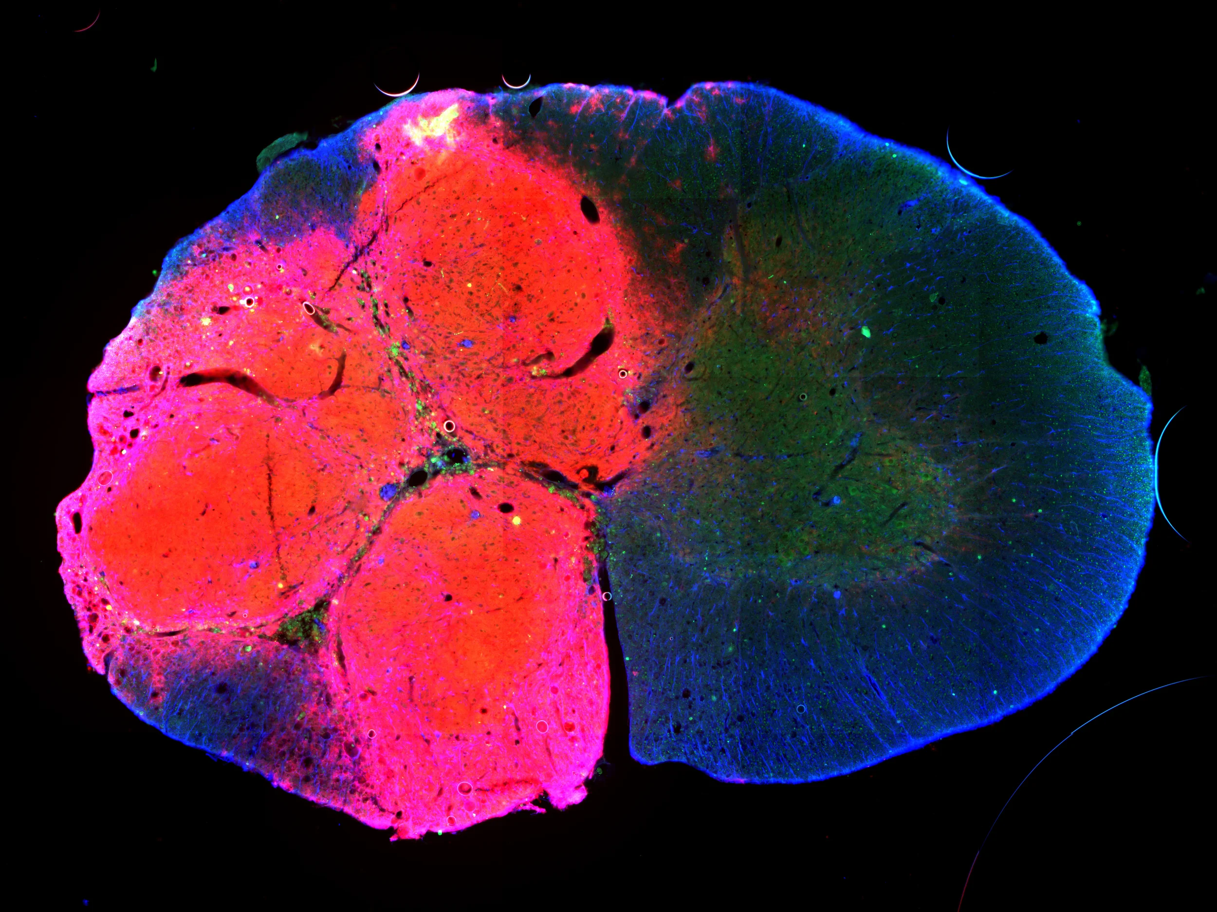 Cell Transplantation