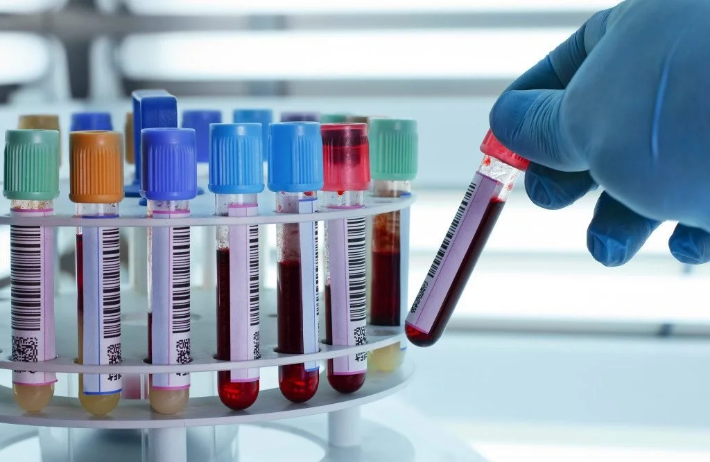 Advanced Lab Testing — Dr. Cohl: Functional Medicine