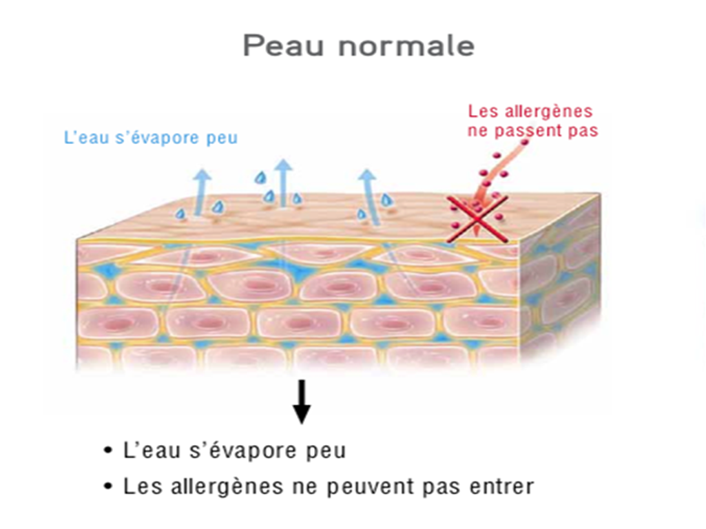 Fondation dermatite atopique*