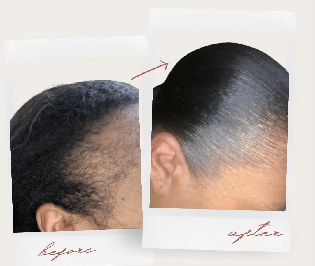 Side-by-side comparison of a woman's hair before and after using Calvaniece Mason Hair Brands Co. hair care products, showing significant hair growth and a sleek, shiny hairstyle after treatment.