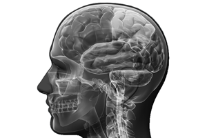 Brain.png