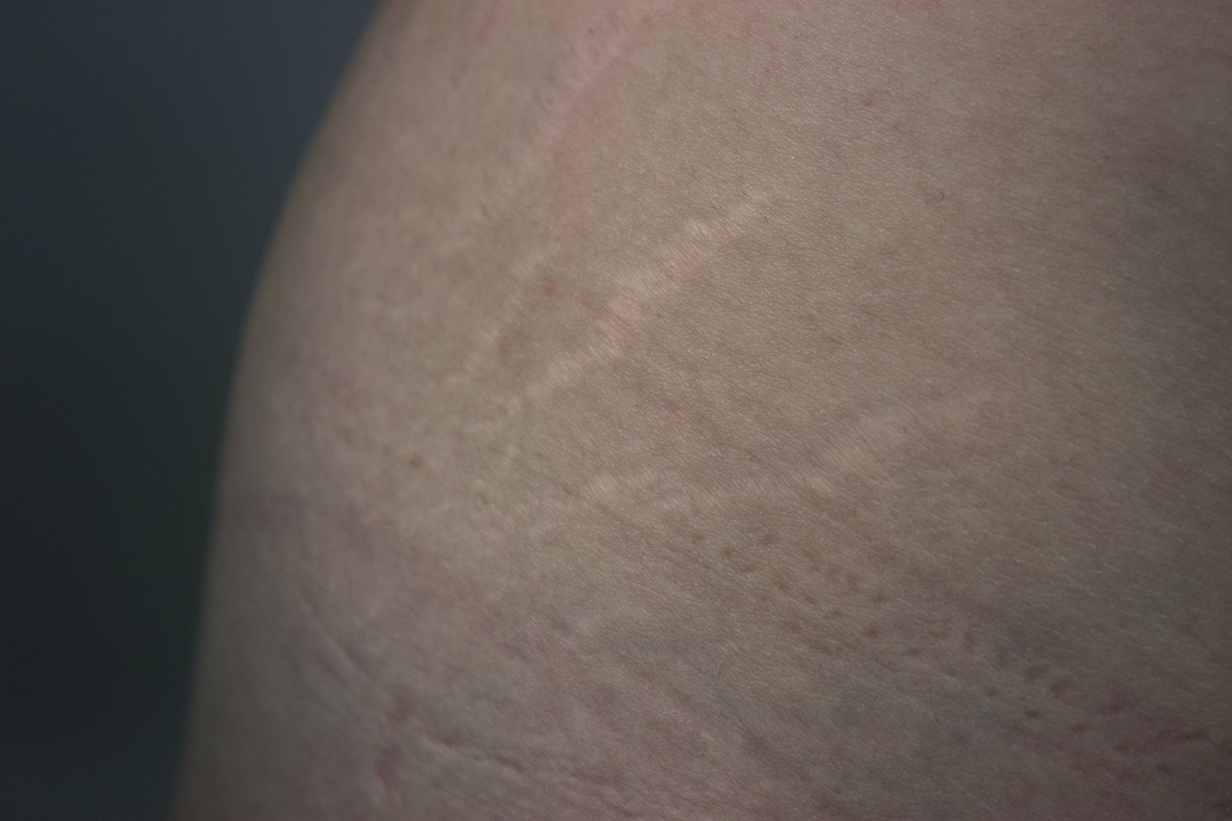 Thunder Thighs Breed Lightning