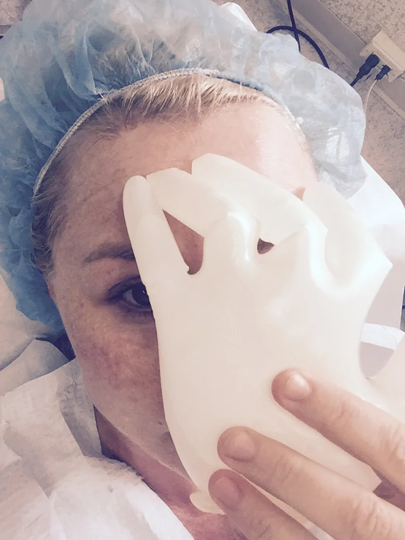 Beauty Roadtest: IPL