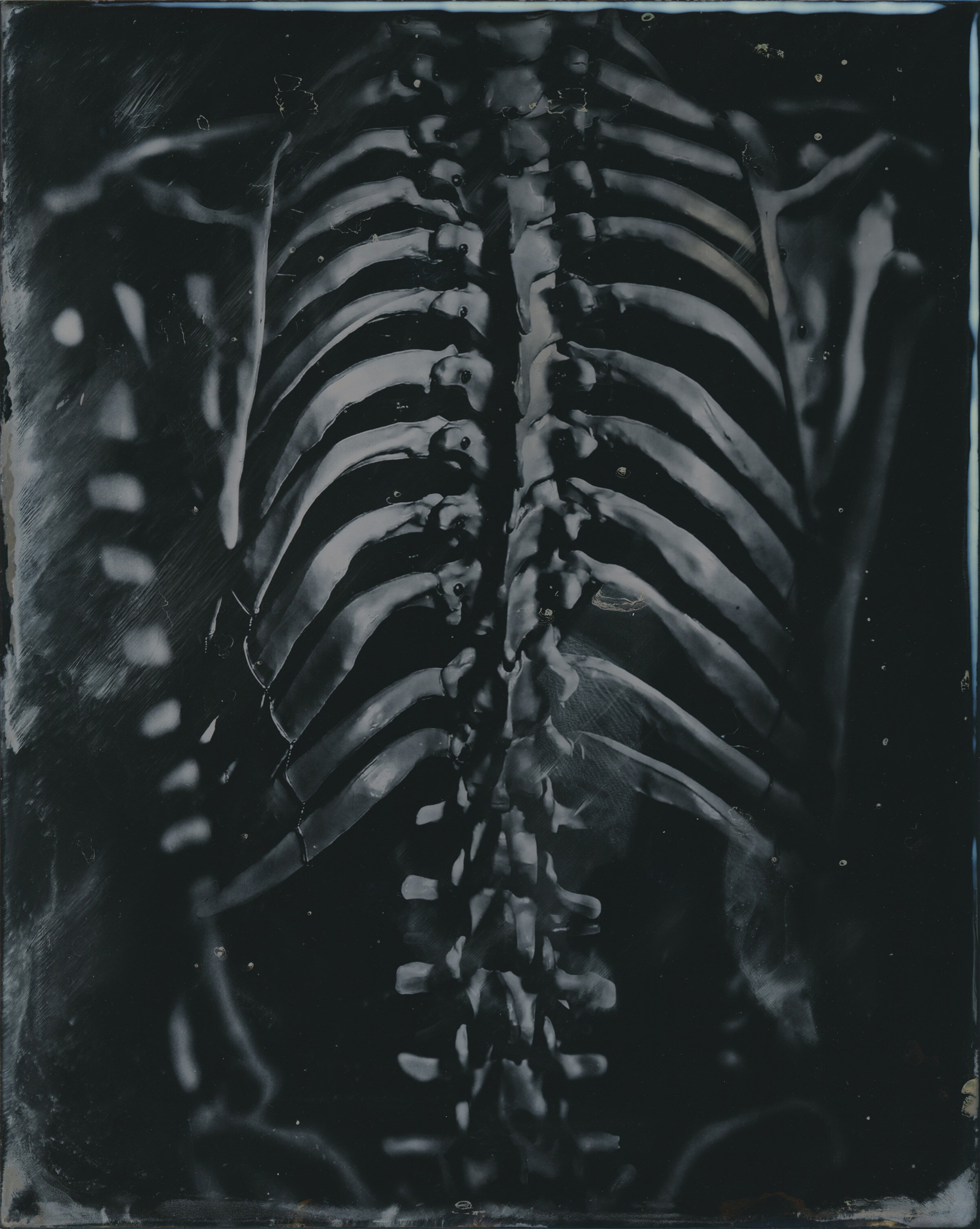 Spine_tintype.jpg