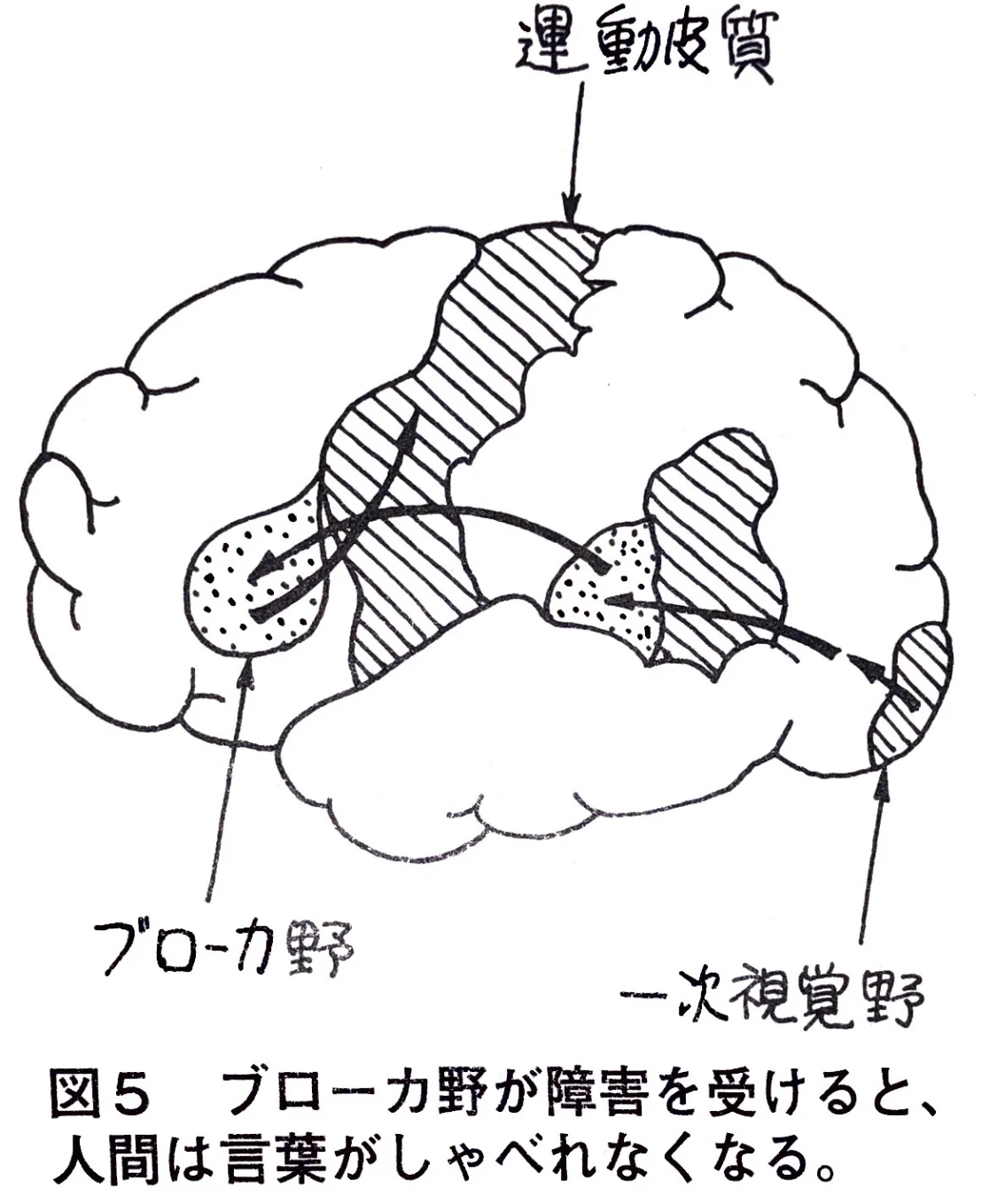 ブローカー野.jpg