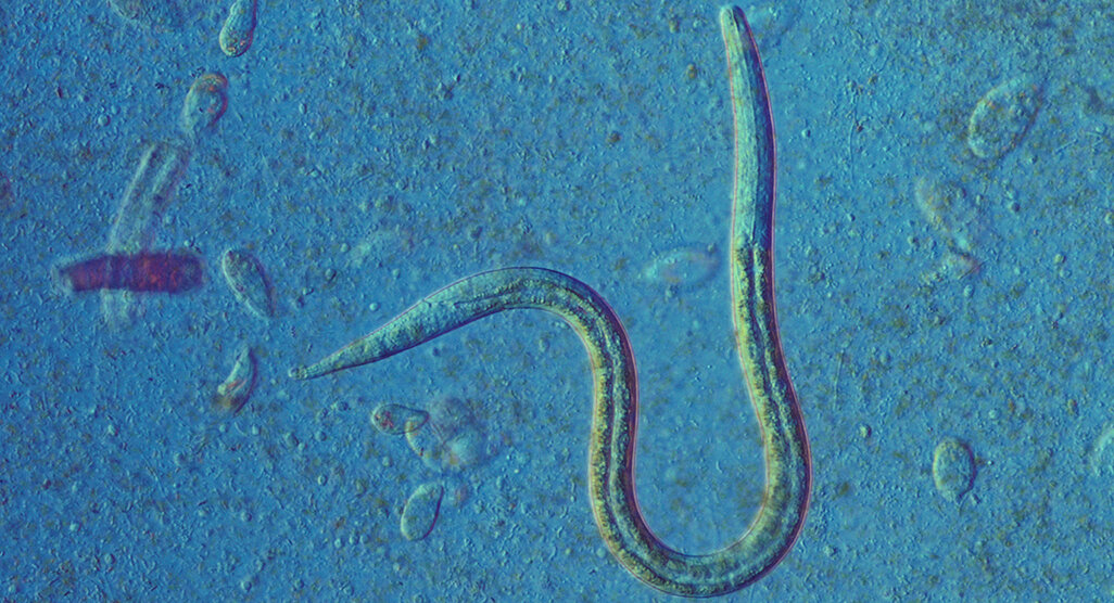 🐛 Threadworm Cases in School