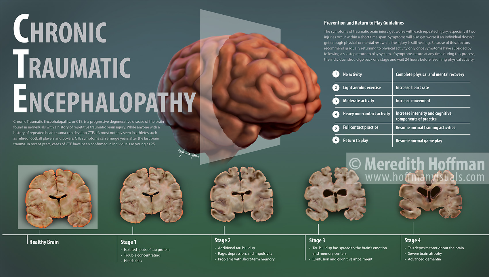 Chronic traumatic encephalopathy