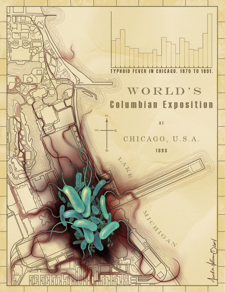 Typhoid at the Chicago World's Fair