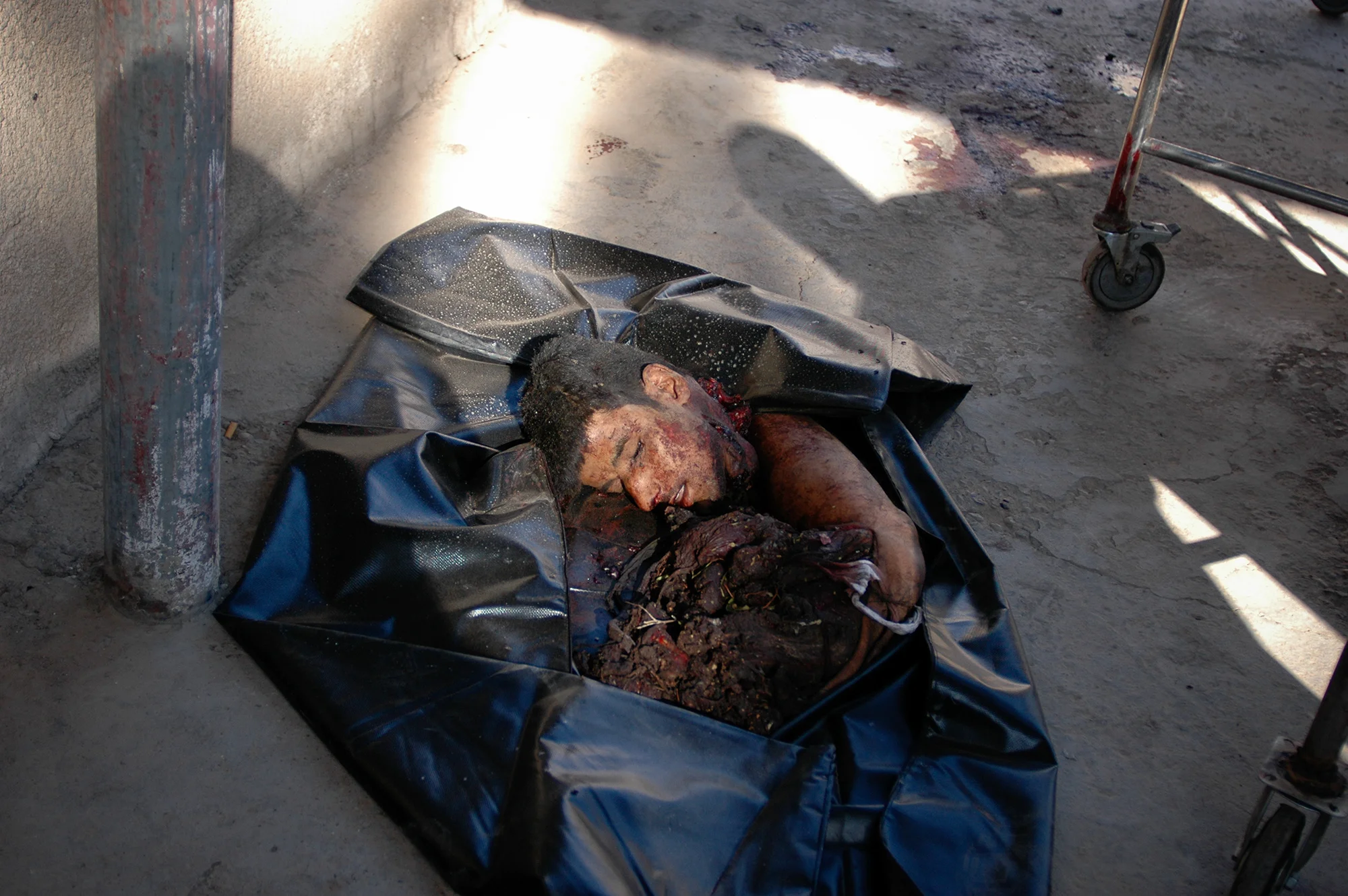 BAGHDAD, IRAQ May 5, 2005 Remains of suicide bomber who killed 15 people in front of Iraqi Army base, of potential recruits awaiting entry. PHOTOGRAPH by ALAN CHIN