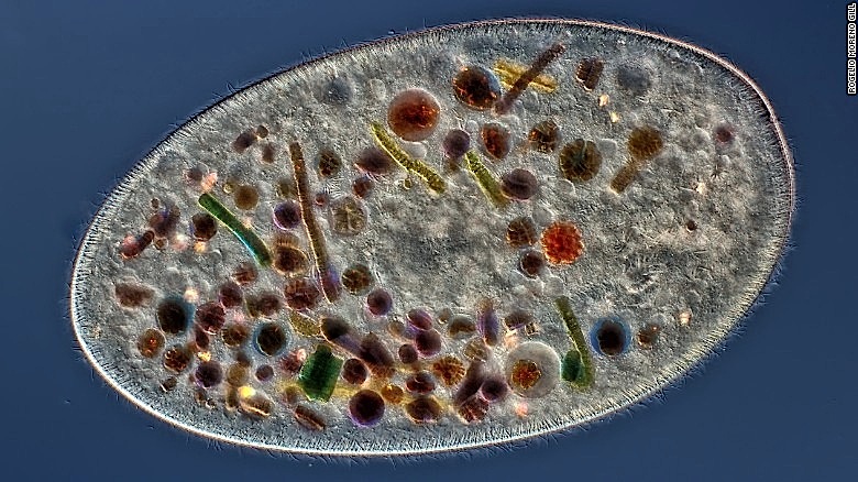 Frontonia Microbe ~ Rogelio Moreno Gill