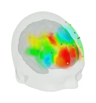 Figure 1: 3D visualization of activation of a Brite23 measurement in OxySoft