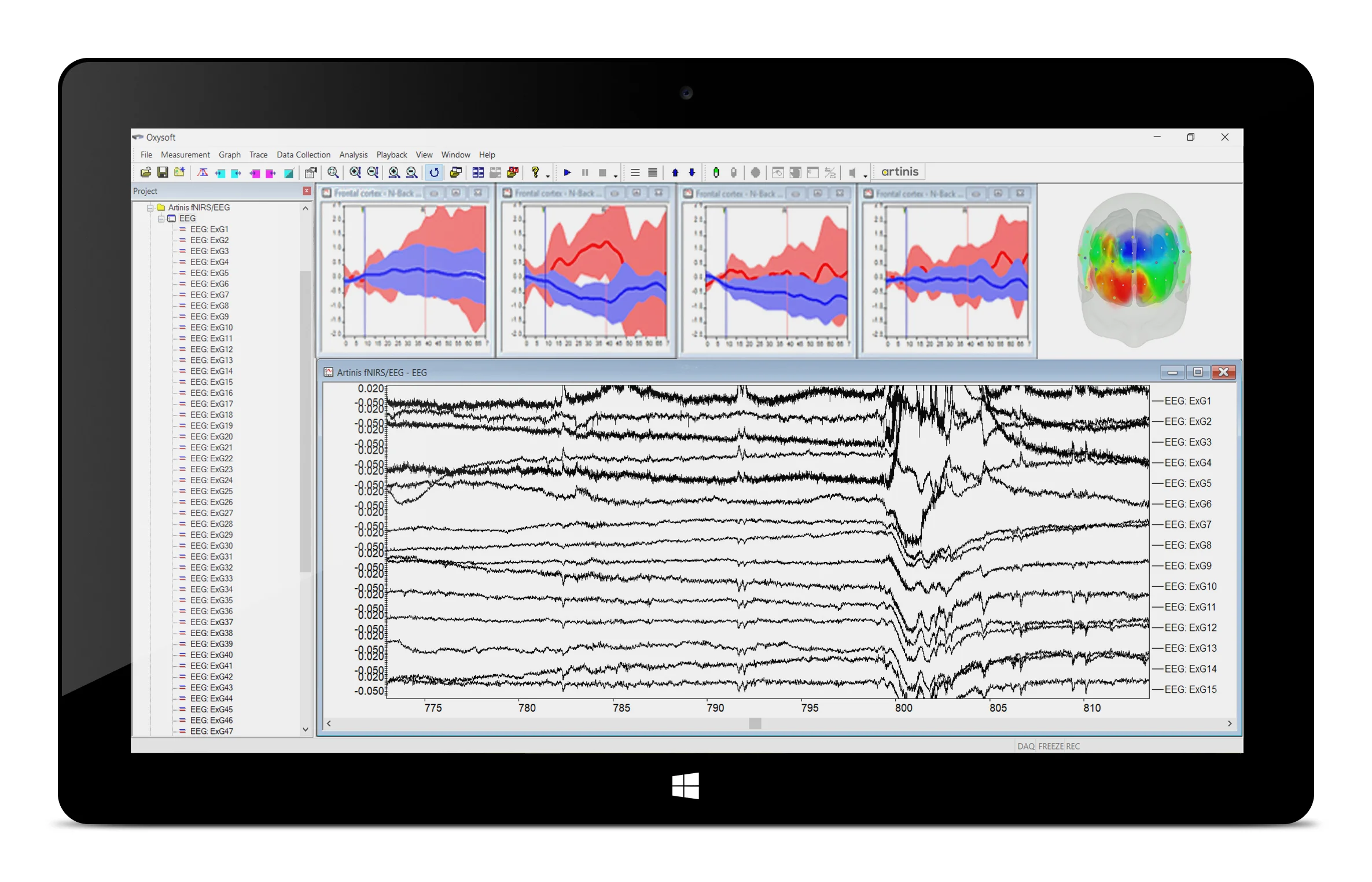 Figure 2. The NIRS-EEG software package, an Oxysoft extension to record EEG-data synchronized with NIRS data.