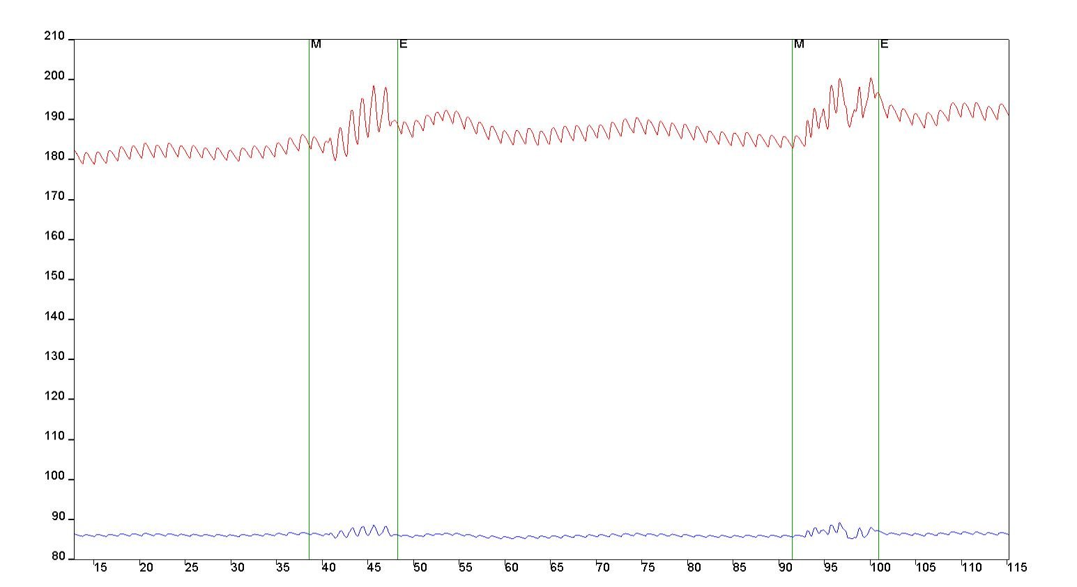 The use of Inertial Measurement Unit (IMU) to detect motion artifacts