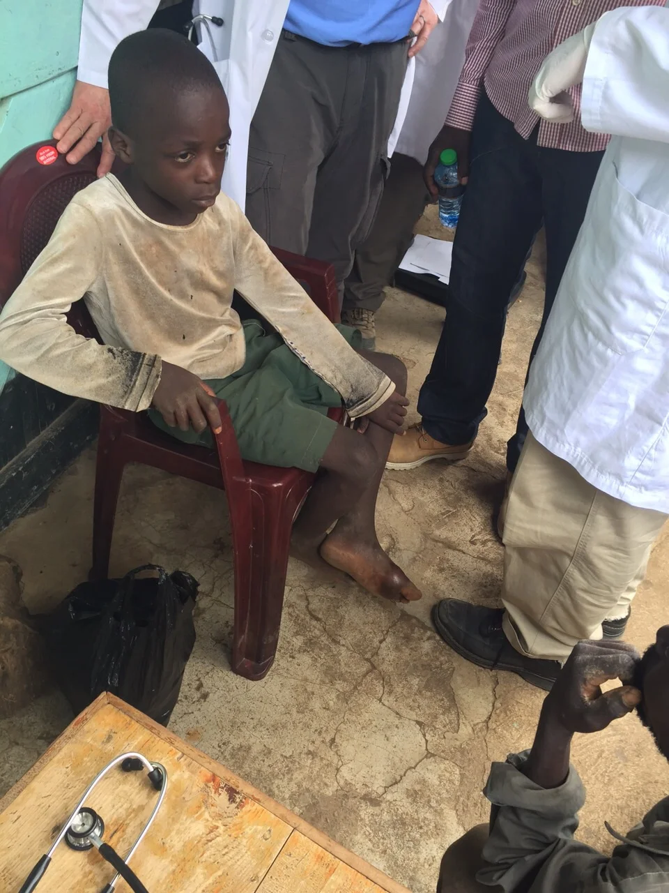 Boy with abscessed foot