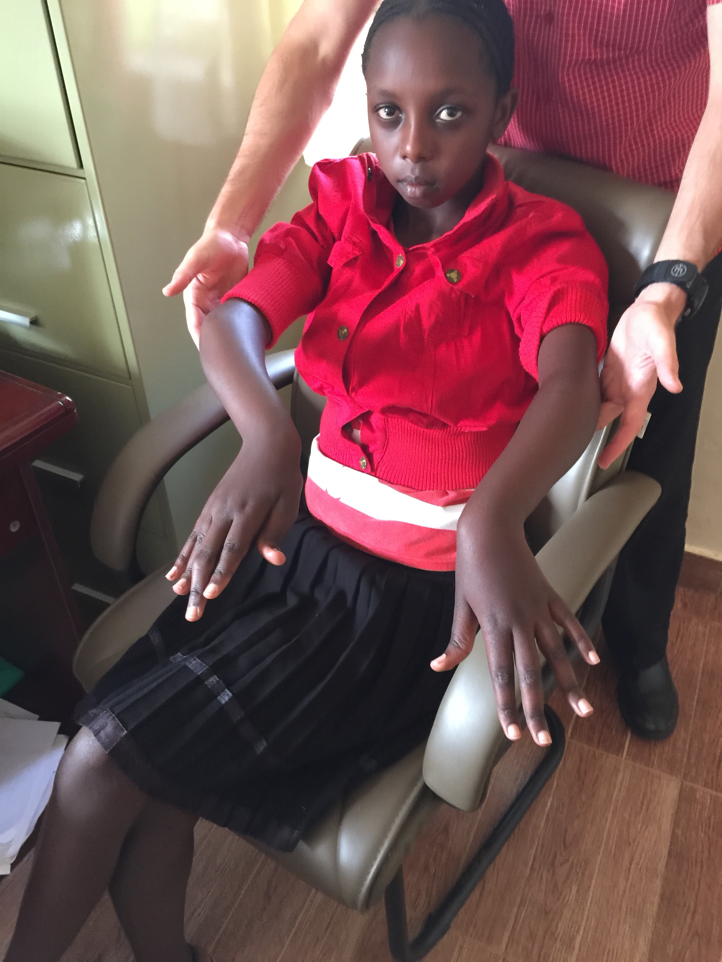 A young girl who suffers from juvenile rheumatoid arthritis. She is part of Naweza's Complex Case Care program whereby the doctors in Canada can discuss complex cases on a bi-weekly basis with the clinical officers in Kenya.