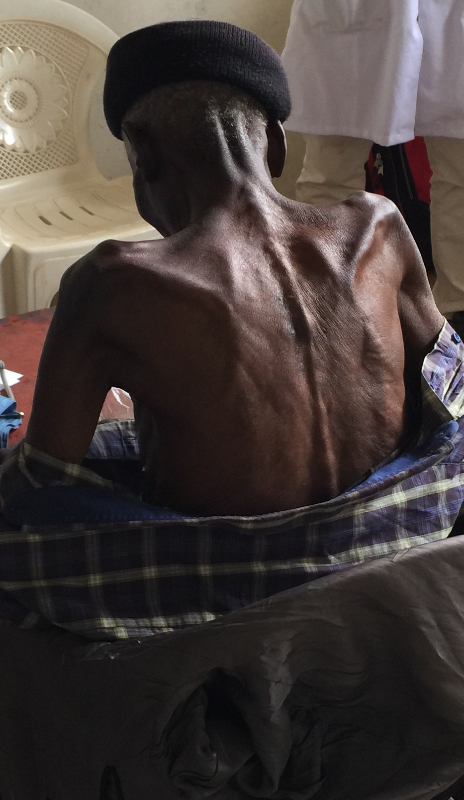 A man who is suffering from COPD, a chronic lung disease, which causes a wasting away of the body. Very hard to see.
