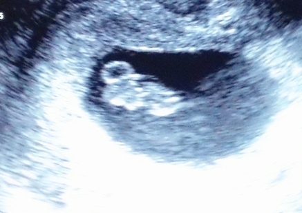 Another Beautiful Peanut