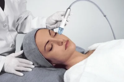 Microdermabrasion image.jpg