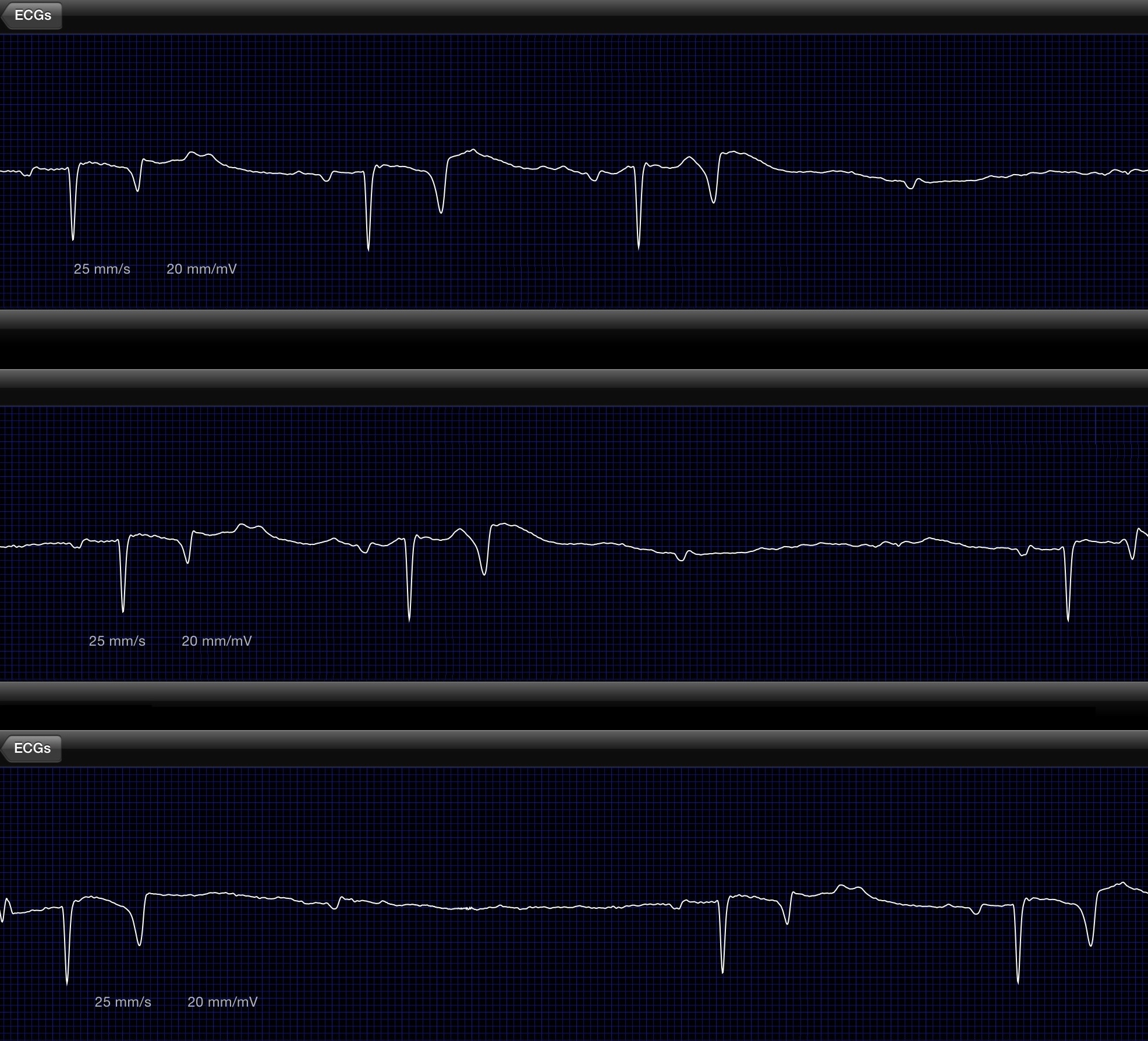 ECG Equivet Stock Image.jpg