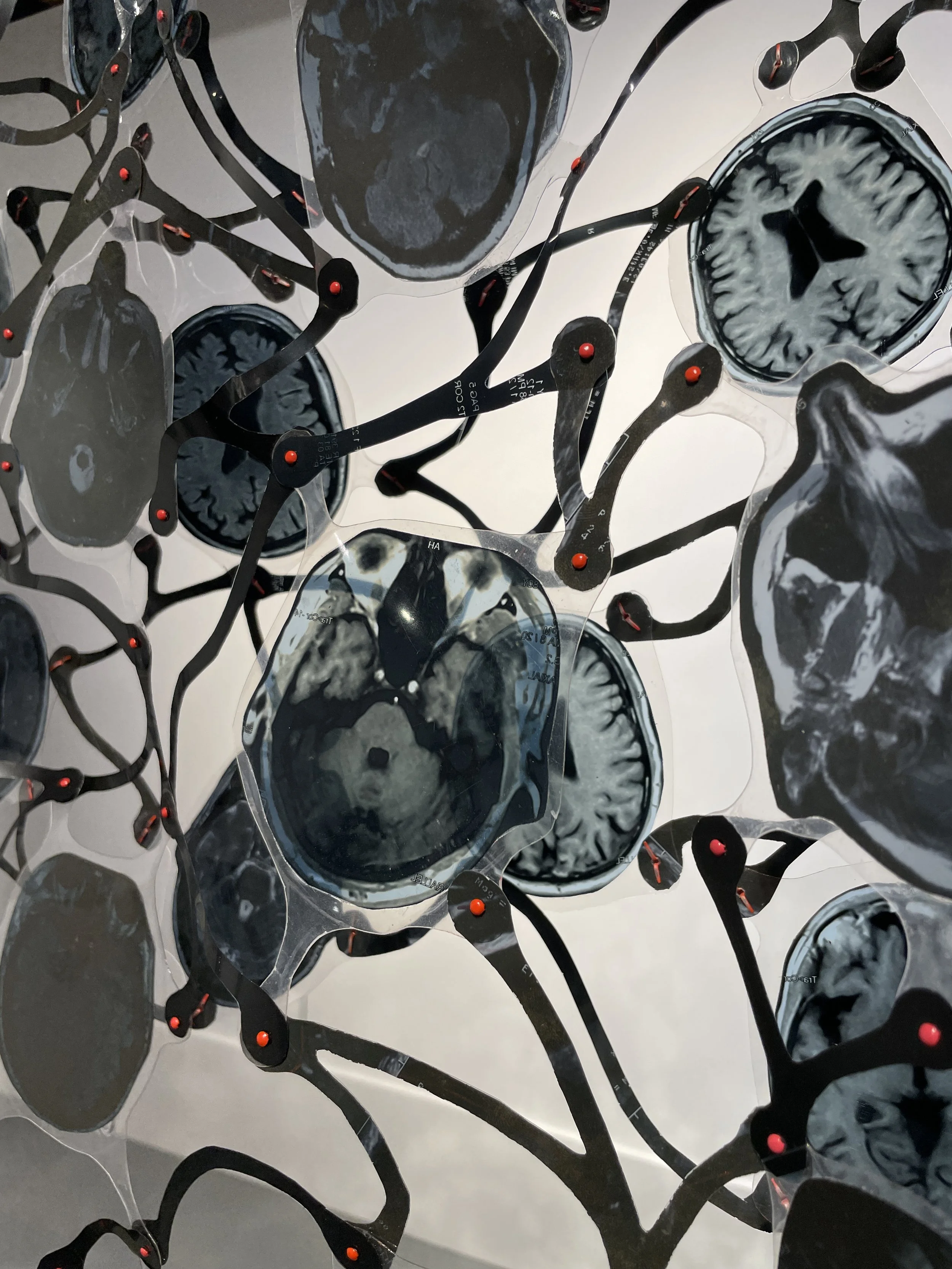 parental poncho detail