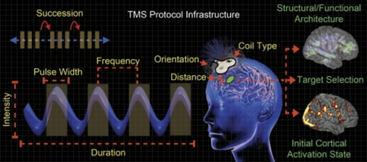 System frequency. Transcranial Magnetic stimulation TMS. ТМС головного мозга. ТМС транскраниальная магнитная стимуляция для детей. Методика транскраниальной магнитной стимуляции.