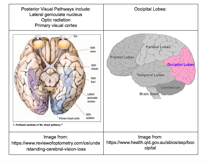 Image from: https://www.reviewofoptometry.com/ce/understanding-cerebral-vision-loss Image from:https://www.health.qld.gov.au/abios/asp/boccipital