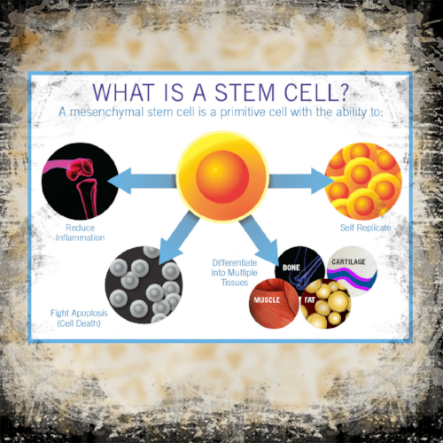 Dr. Pedro Loredo uses your own stem cells to help treat your joint pain and injury. Please call at 972-939-4974 or visit our website www.loredohands.com