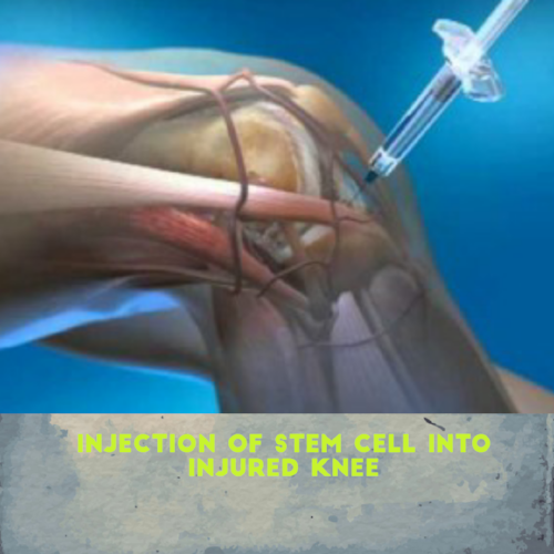 Dr. Pedro Loredo from Loredo Hand Care Institute injects the stem cells into the injured joint. Please call us at 972-939-4974 or visit our website www.loredohands.com