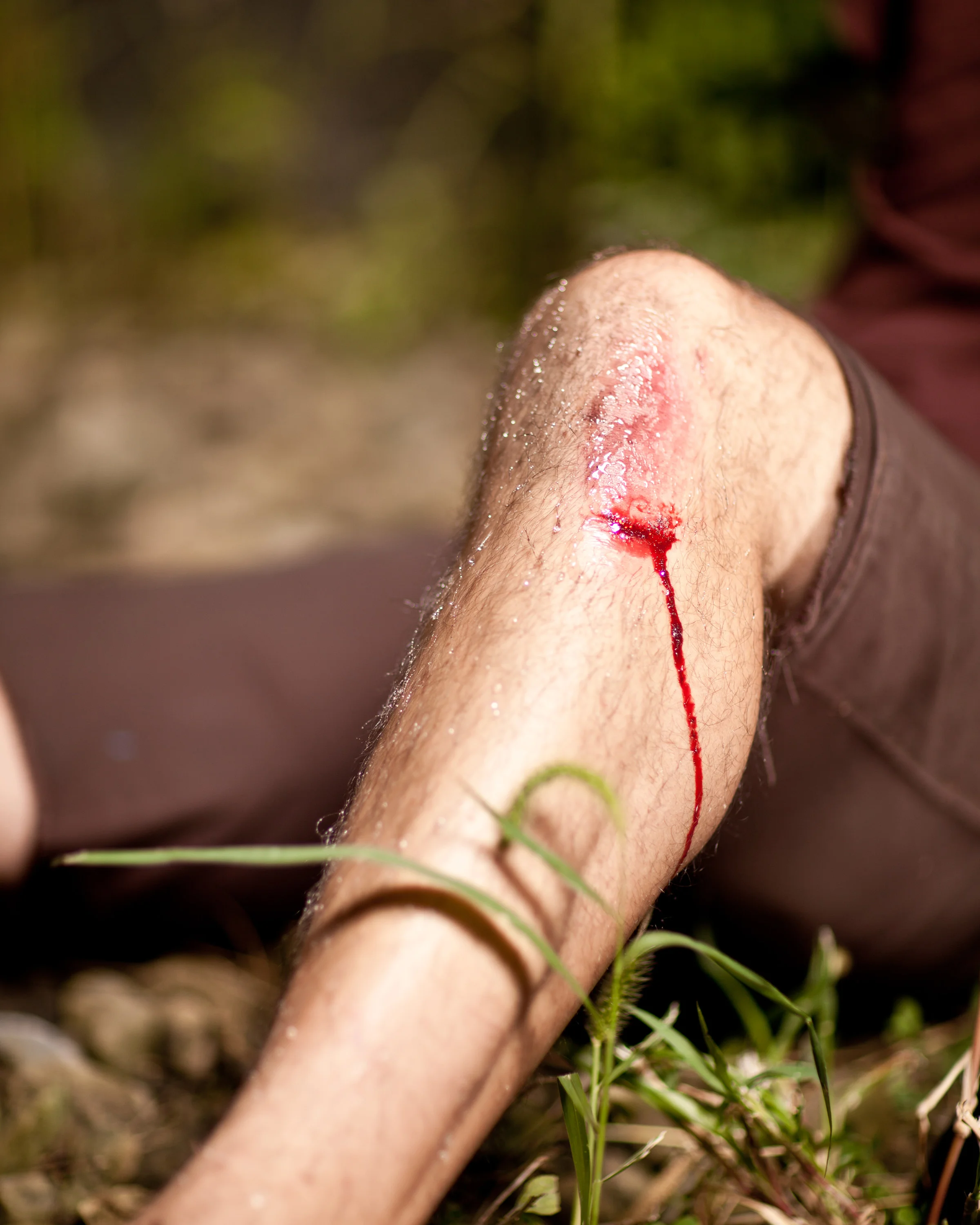 04_Knee_20120830-093.jpg
