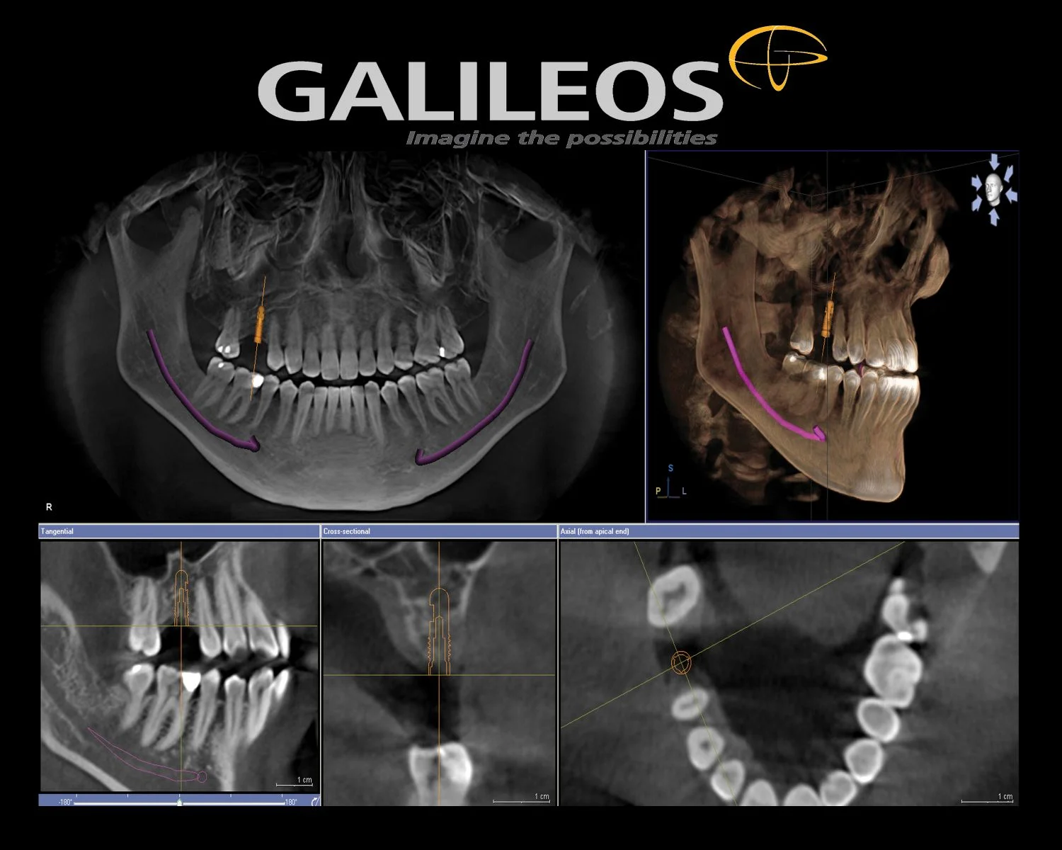 gali.jpg