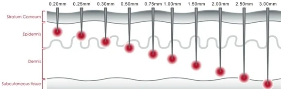dermaroller needle sizes http://dermarollerqmd.com/wp-content/uploads/2016/02/dermaroller-needle-sizes.jpg