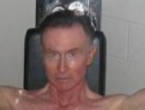 It's blurry, no matter. Tom Hagerty at 74 http://www.hairloss-reversible.com/my-story/