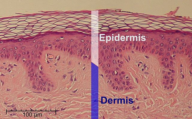 Normal Epidermis and Dermis(Public Domain) Cropped and labeled by Fama Clamosa / Mikael Häggström