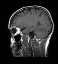 Human-Brain
