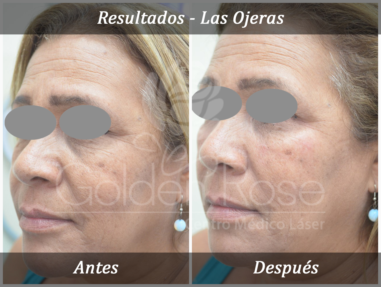 Results - Las Ojeras 3.jpg