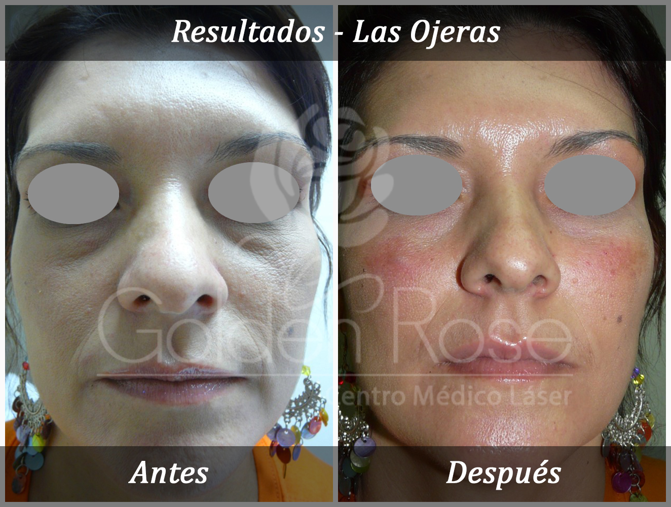 Results - Las Ojeras 2.jpg