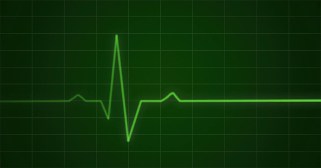 concept-animation-of-an-ecg-or-ekg-heartbeat-cardiogram-on-a-green-monitor-in-4k_4nki2zf8g__F0000.jpg