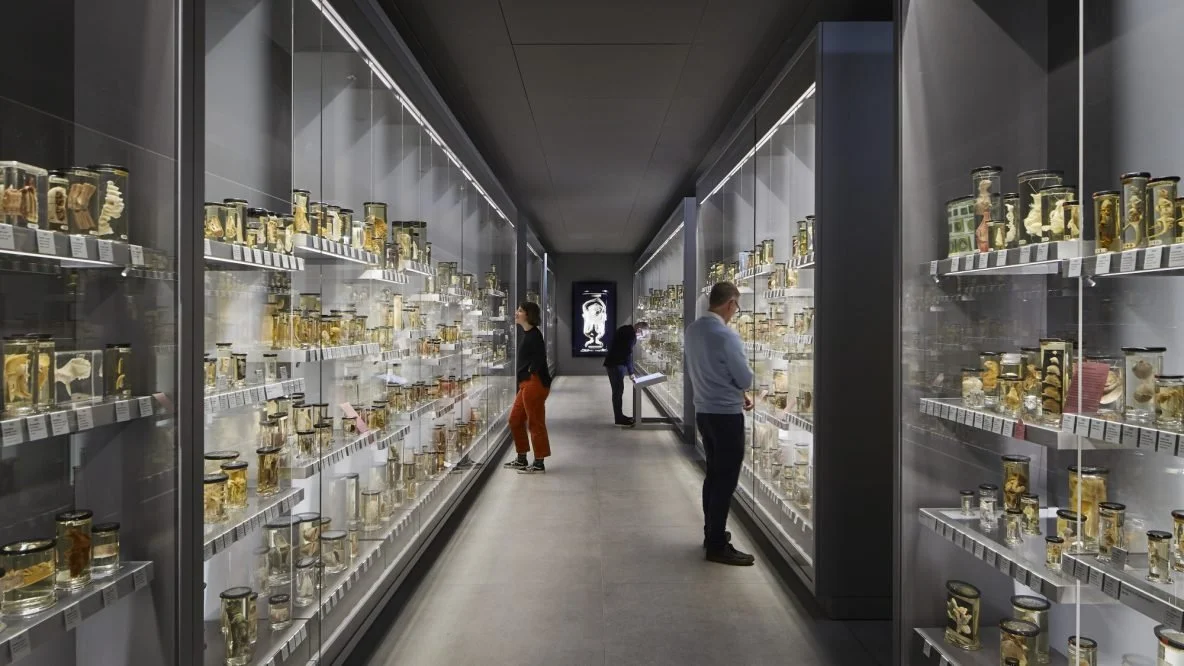 Hunterian Museum Questionable Things in Jars