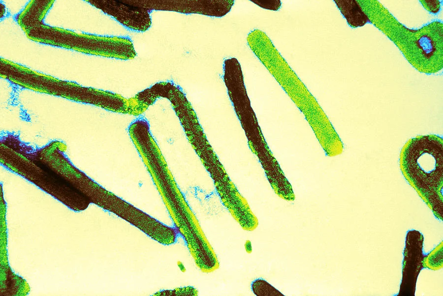Marburg virus (PC: FineArtsAmerica)