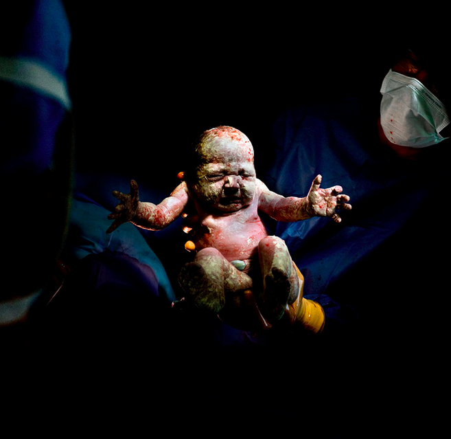 Portrait of a child born through Cesarean procedure, captured a few seconds into life.